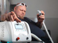 aspects to consider for laser tattoo removal 200x150 1