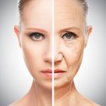 ultherapy for facial skin tightening 200x150 1  mirabile md - ultherapy for facial skin tightening 200x150 1