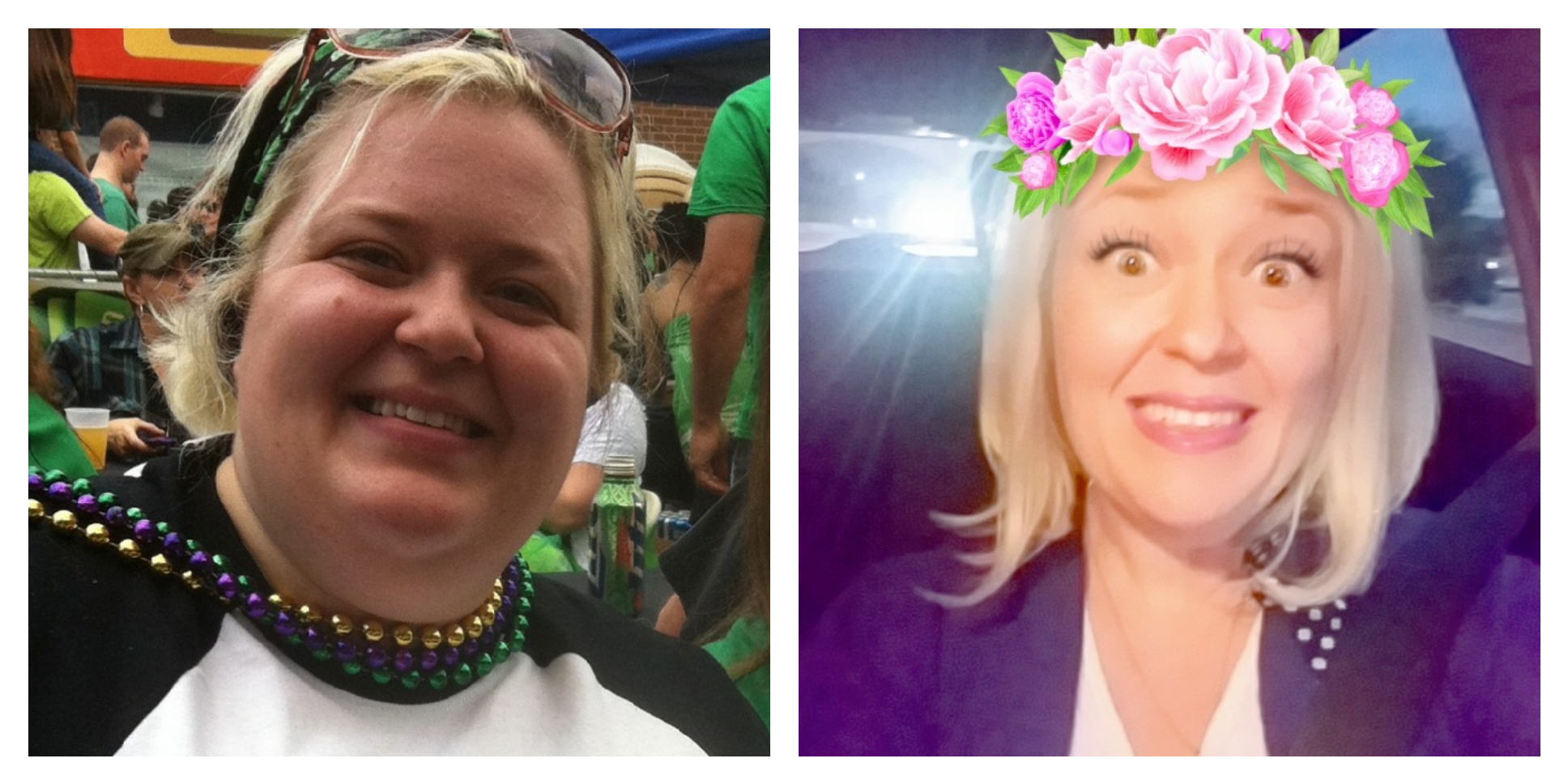 cassidy before and after