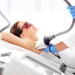 laser hair removal