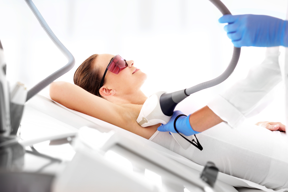 laser hair removal