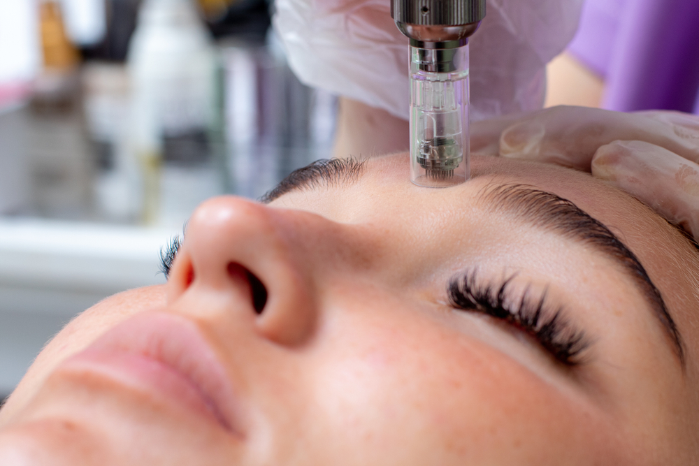 4 Anti-Aging Facial Treatments That Really Work - Mirabile MD