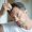 prf hair loss treatment