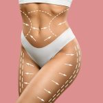 evolvex vs morpheus8 vs coolsculpting scaled 3