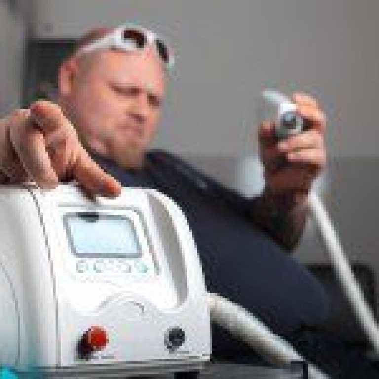 aspects to consider for laser tattoo removal 200x150 1