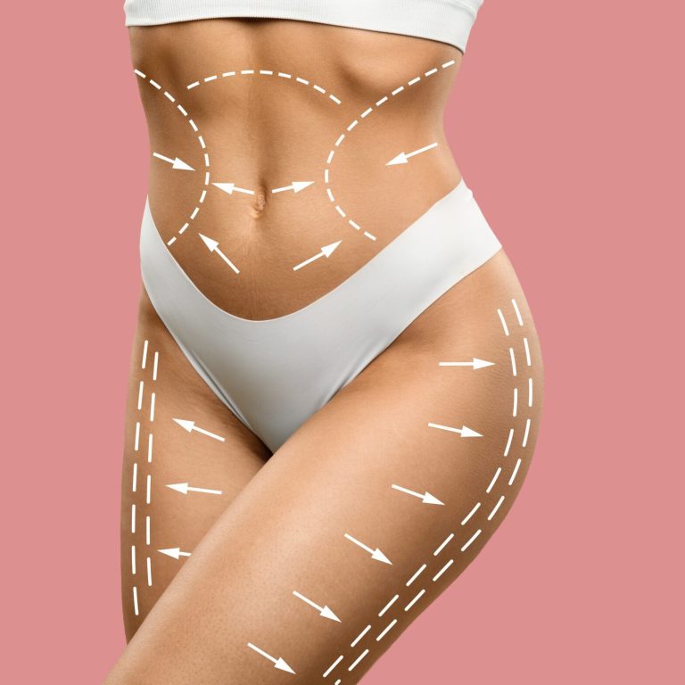 evolvex vs morpheus8 vs coolsculpting scaled 3