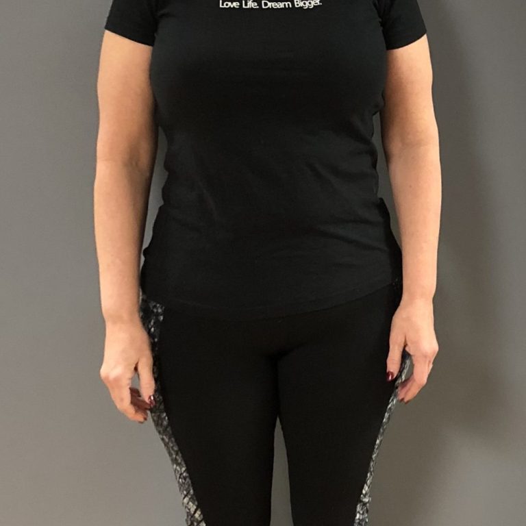 lori holmes after 91 lbs scaled