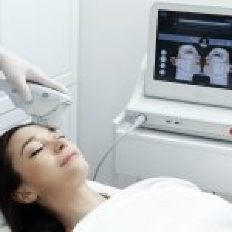 review on ultherapy 200x150 1