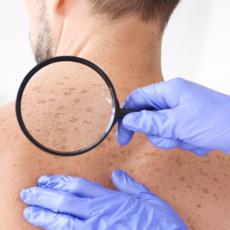 where do sunspots come from 3