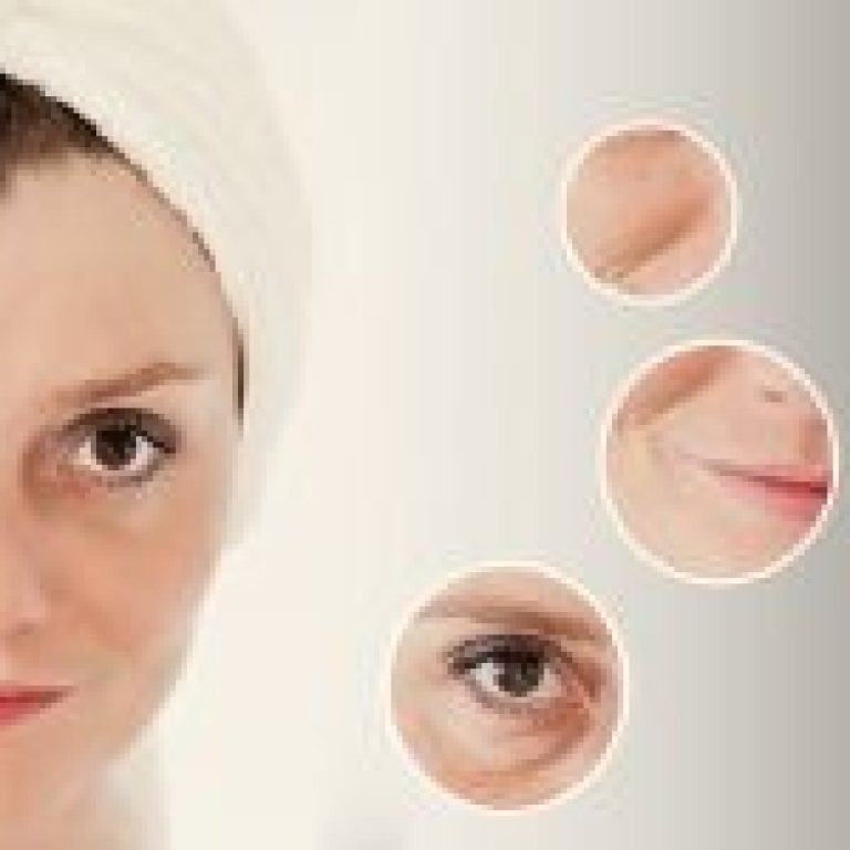 why ultherapy for skin tightening 200x150 1